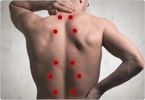 trigger point injections scottsdale az